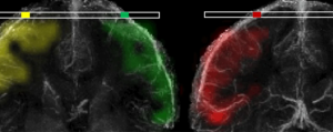 Animated visualization demonstrating how DiSpect traces the origin of blood arriving to different cortical veins in the brain, resolving their territories. (Image courtesy of Ekin Karasan)