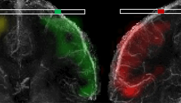Animated visualization demonstrating how DiSpect traces the origin of blood arriving to different cortical veins in the brain, resolving their territories. (Image courtesy of Ekin Karasan)
